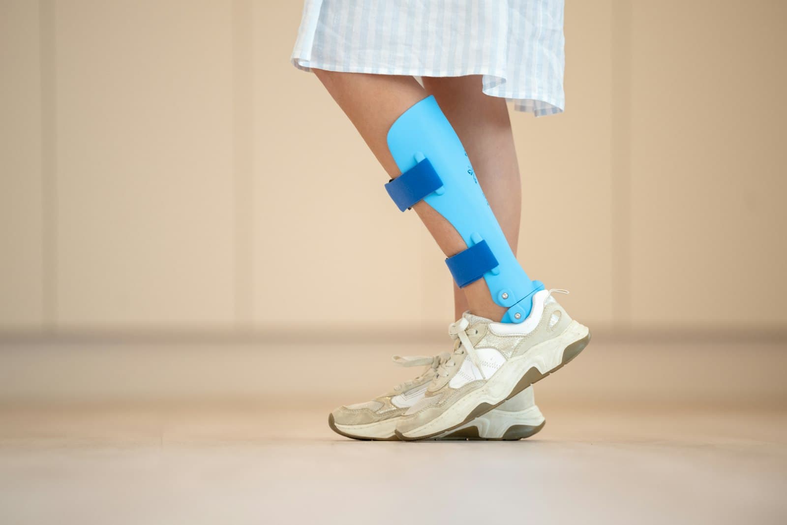 Orthopaedic cast on a leg